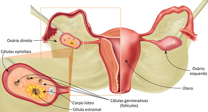 Ovário – Neoplasias – (5ª edição – 2019)