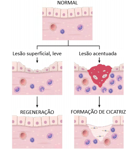 Imagem ilustrativa que mostra os processos dos Mecanismos de reparo tecidual: regeneração e formação de cicatriz.