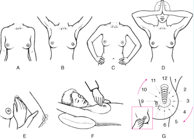 Ilustrações de Exames físicos das mamas.